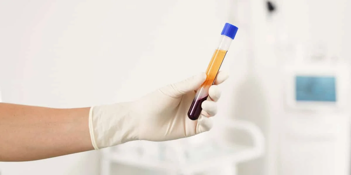 How PRP Treatments Can Renew Your Skin