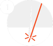 laser hair removal step 1