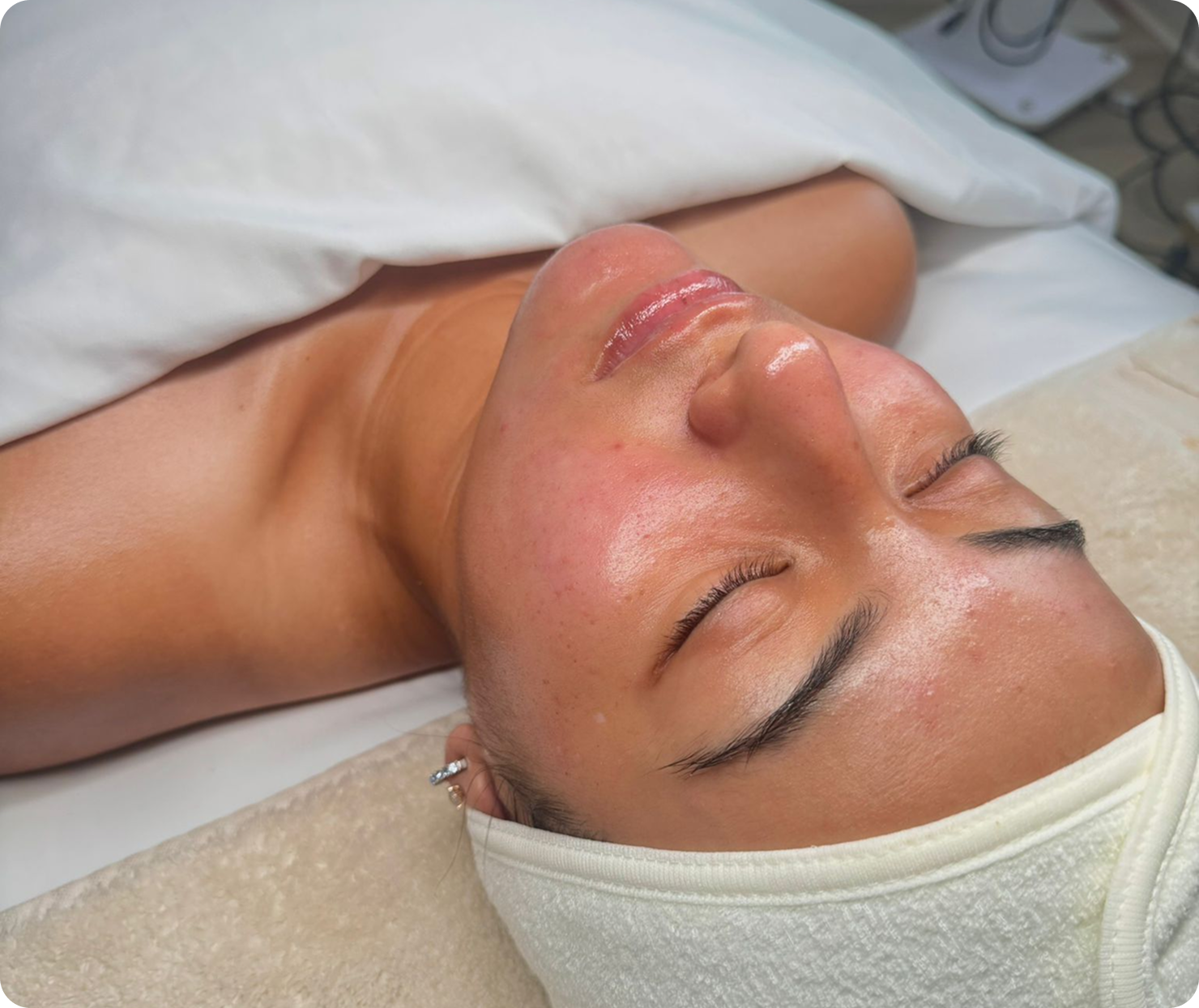 Medical-Grade Facial Package